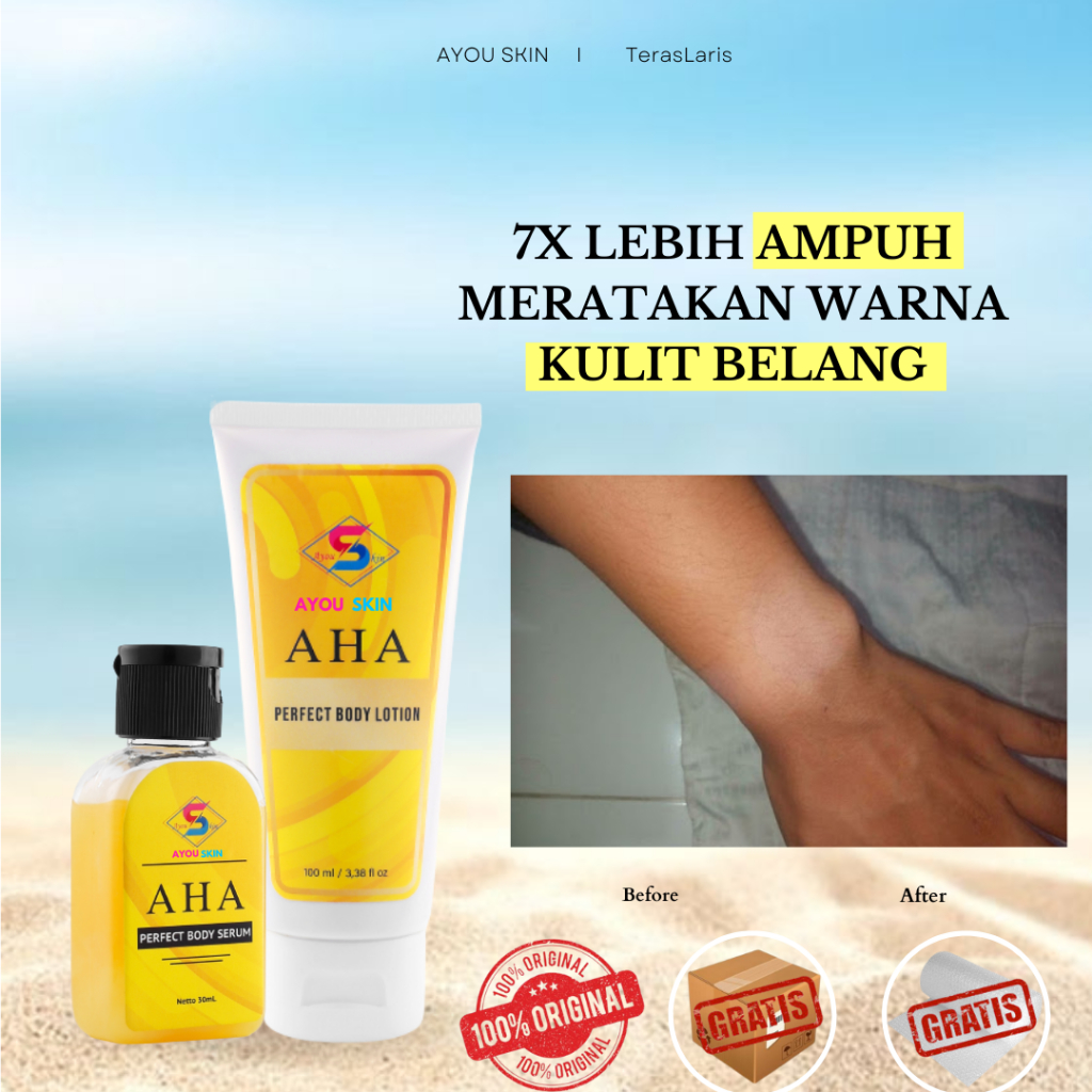 Krim Penghilang Kulit Belang, Penghilang Kulit Belang Di Tangan, Pemutih Kulit Kaki Belang, Lotion P