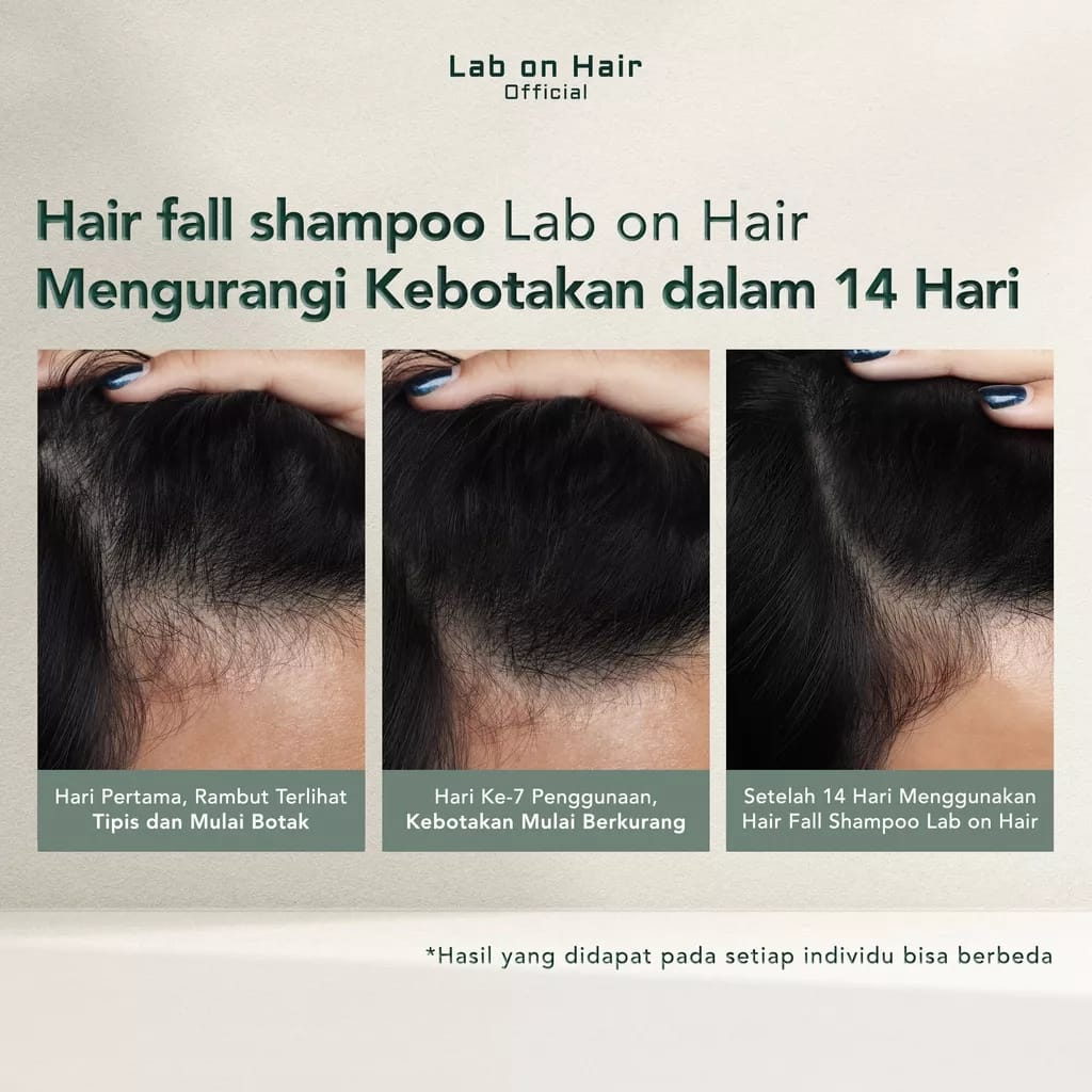 ( Free Souvenir ) - Lab On Hair - Shampoo / Perawatan Rambut Anti Rontok Anti Lepel 300ml