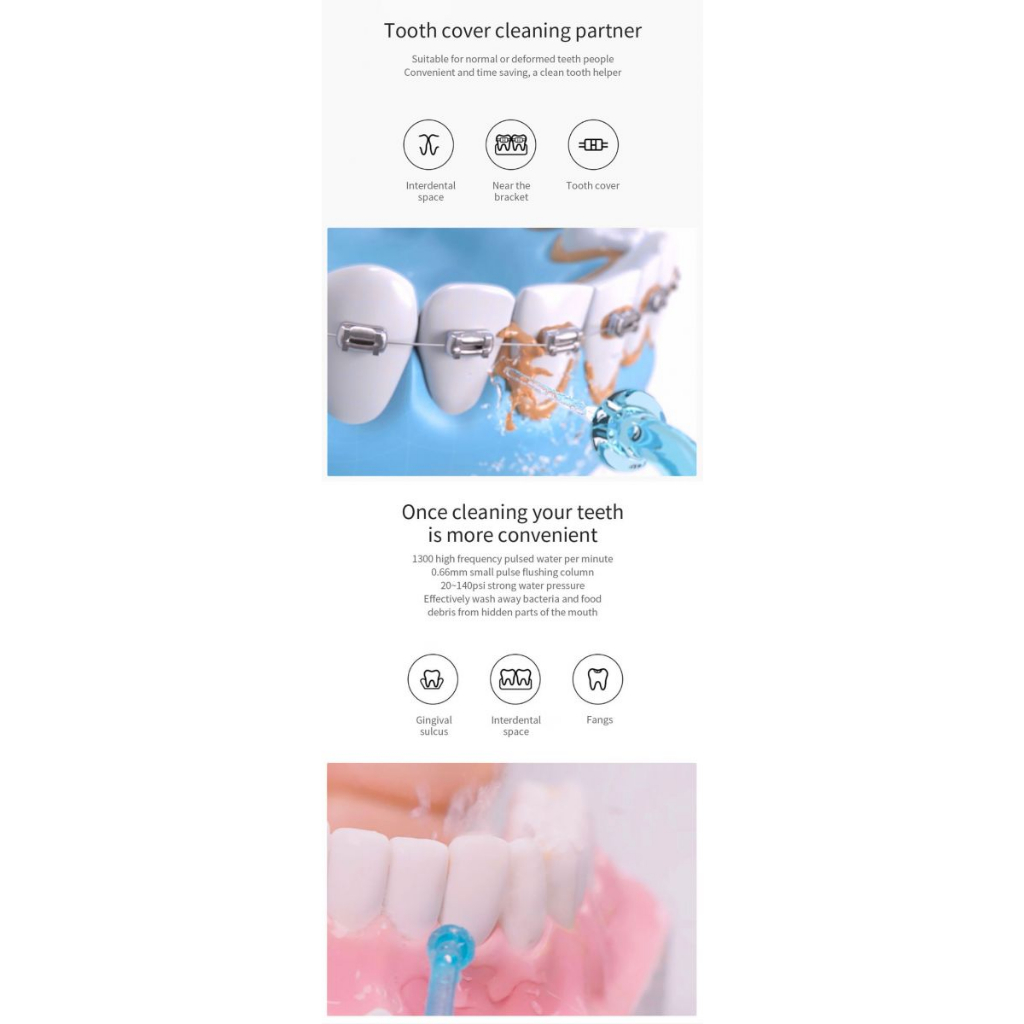 SOOCAS Semprotan Pembersih Sela Gigi Teeth Scaling Dental Device - W3