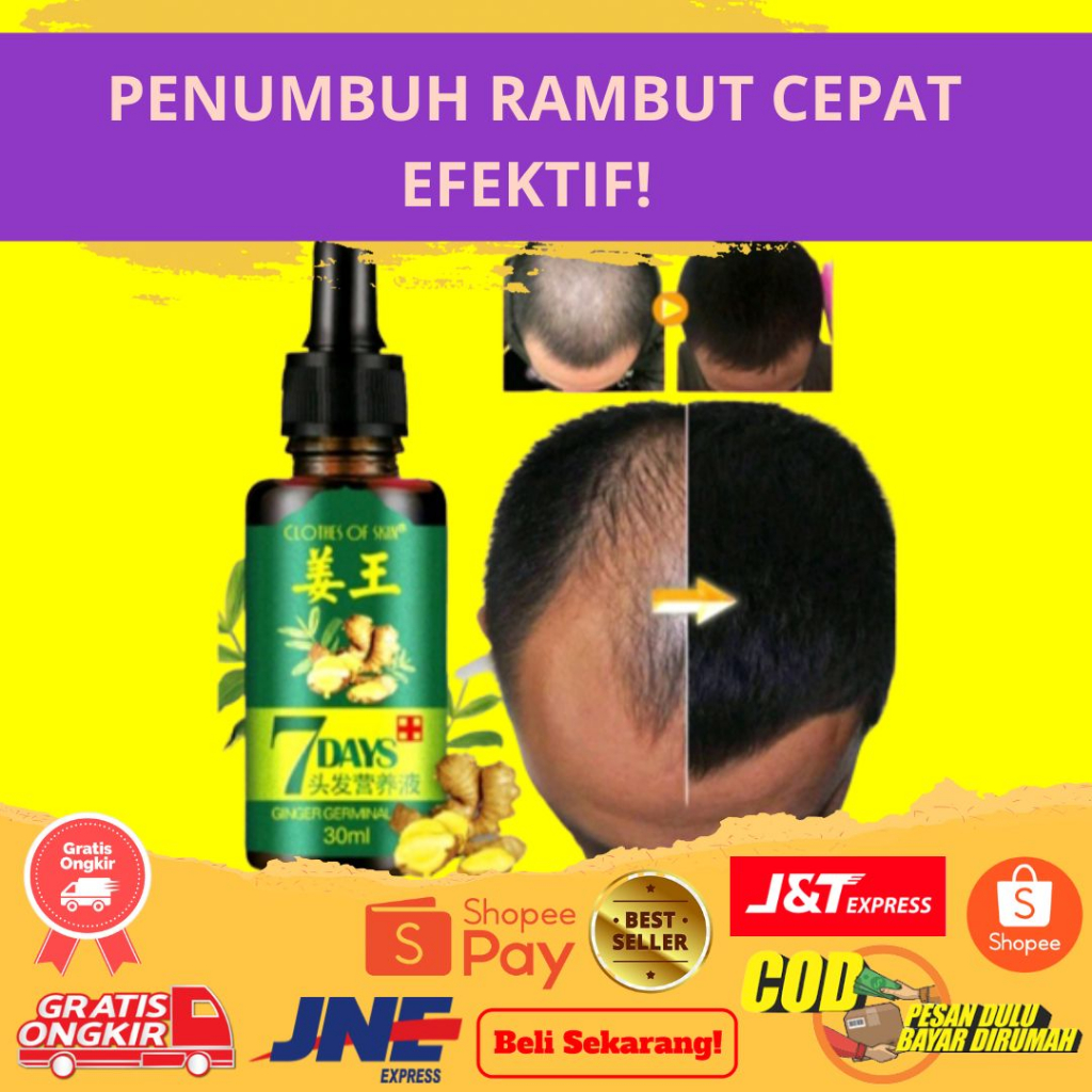 ⭐️⭐️BIG SALE⭐️ ⭐️ORIGINAL7 Days Clothes Of Skin Ginger Germinal Oil Minyak Penumbuh Rambut ORI