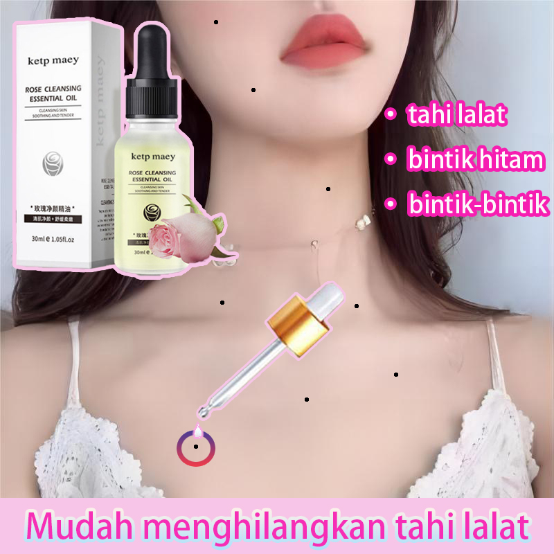 tahi lalat penghilang penghilang tahi lalat obat penghilang tahi lalat penghilang tahi lalat di waja