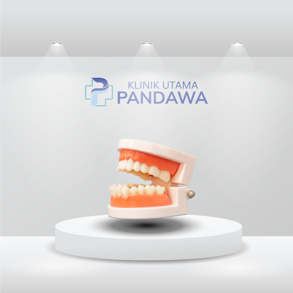 Gigi Palsu (Gigi Tiruan Sebagian Lepasan)