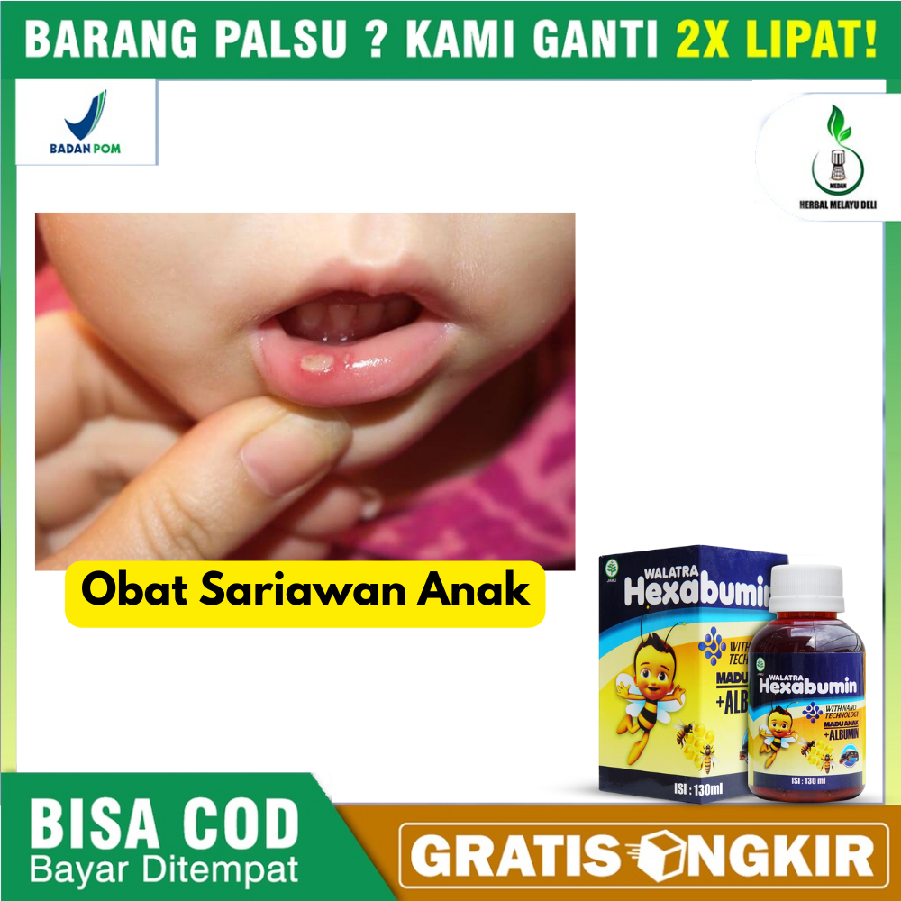 Obat Herbal Untuk  Anak Obat Sariawan Pada Anak Obat Nyeri Tenggorokan Pada Anak Obat Radang Tenggor