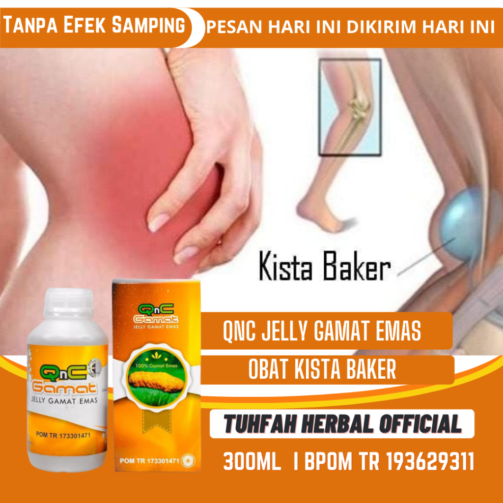 Obat Kista Baker, Penghancur Kista Baker, Obat Benjolan Di Belakang Lutut, Obat Benjolan Di Belakang