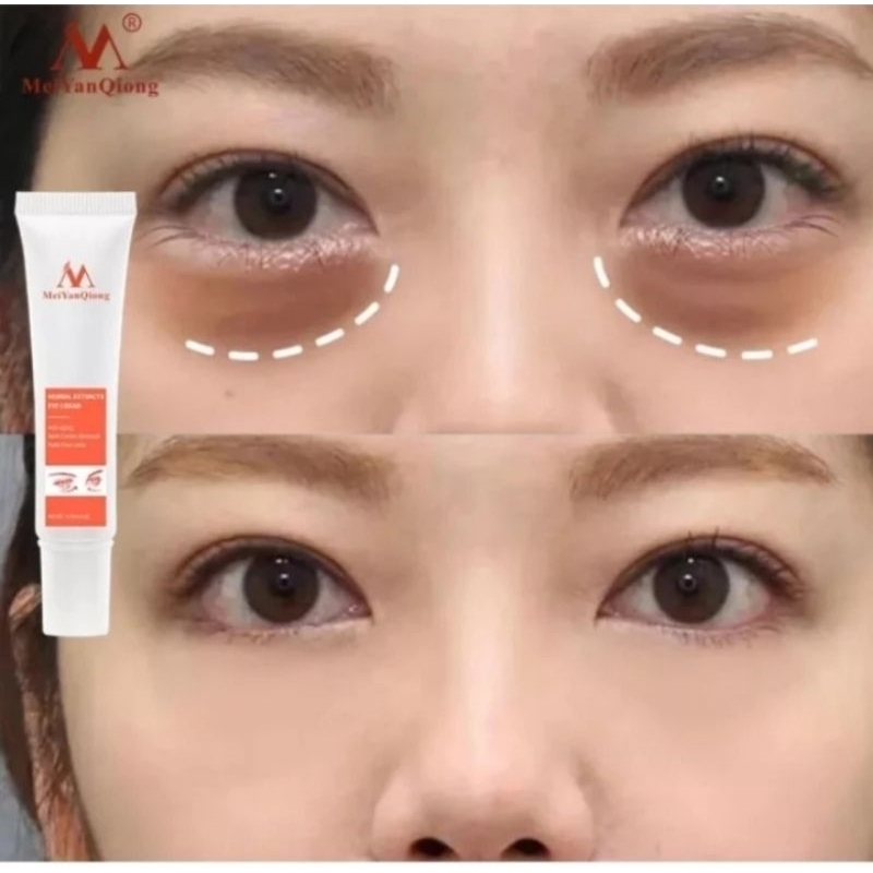 MeiYanQiong herbal extracts  eye cream