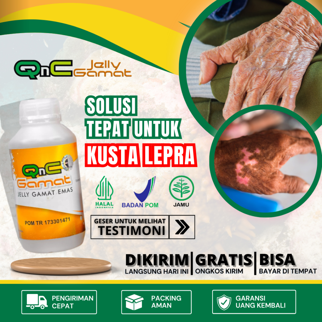 Obat Kusta / Lepra, Kulit Kering, Kulit Mati Rasa, Obat Kusta Kering, Obat Kusta Basah, Luka Pucat, 