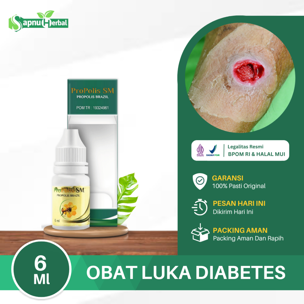 Obat Luka Diabetes Agar Cepat Kering Luka Diabetes Basah Diabetes Kering Luka Diabetes Di Apotik Luk