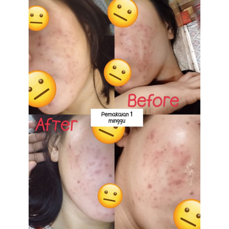 ER Glow Beauty Cream Pemutih Wajah