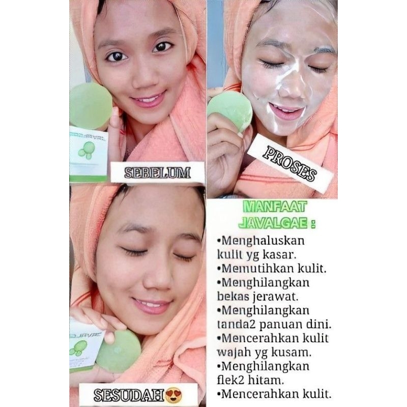 Sabun Muka, Sabun Cuci Muka, Sabun Jerawat, Sabun Flek Hitam