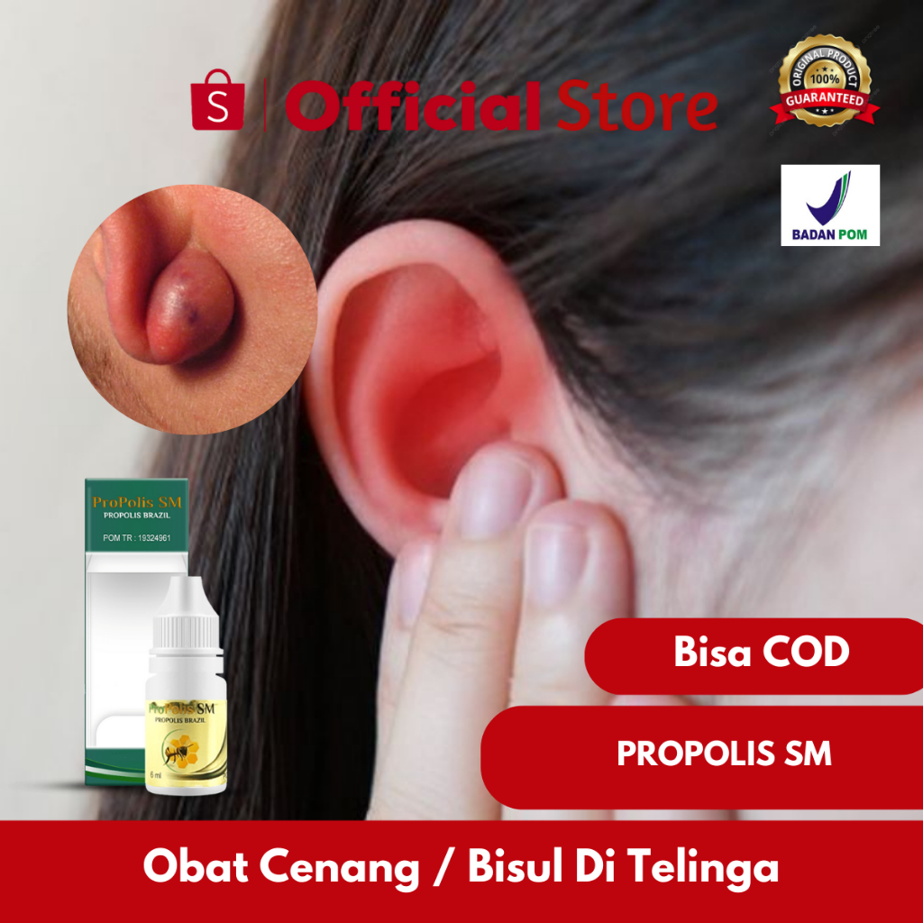 Obat Herbal Cenang / Bisul Di Telinga, Benjolan Di Kelopak Mata, Bisul Bernanah, Propolis SM