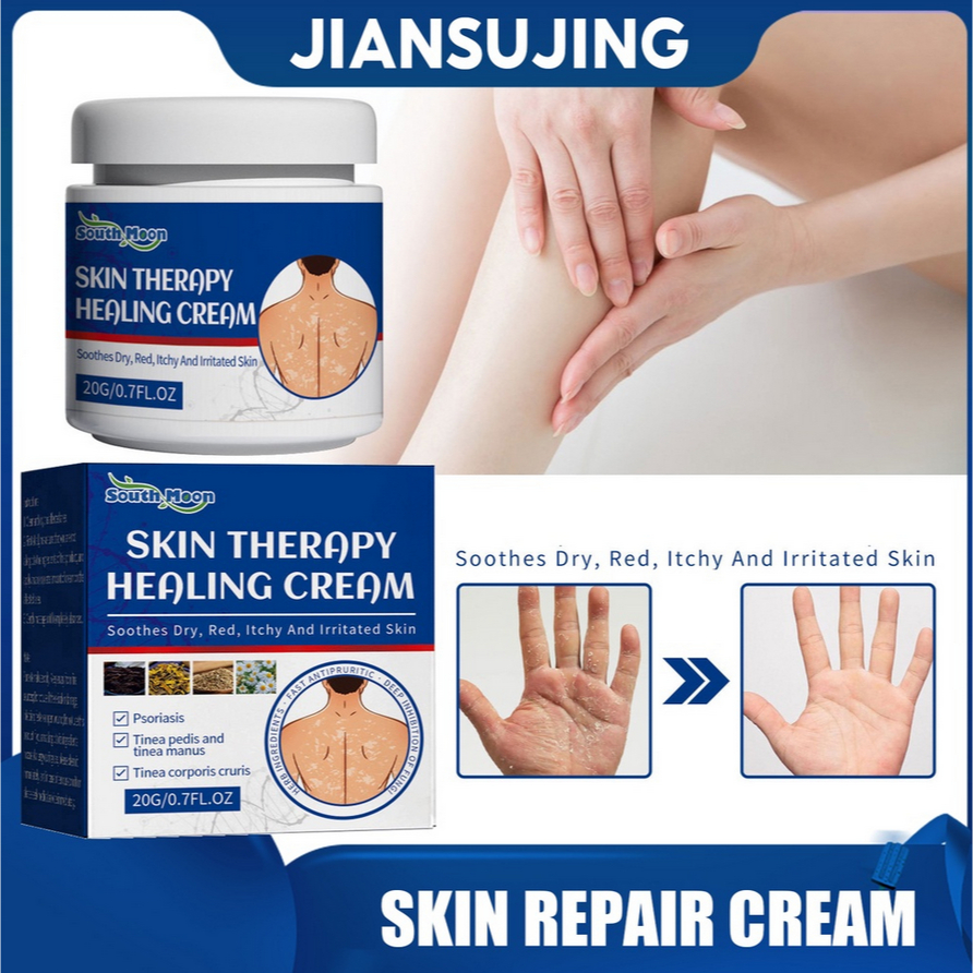 South Moon Terapi Kulit Terapi Penyembuhan Krim Kulit Antipruritik Pereda Gatal Dermatitis Eksim Kri