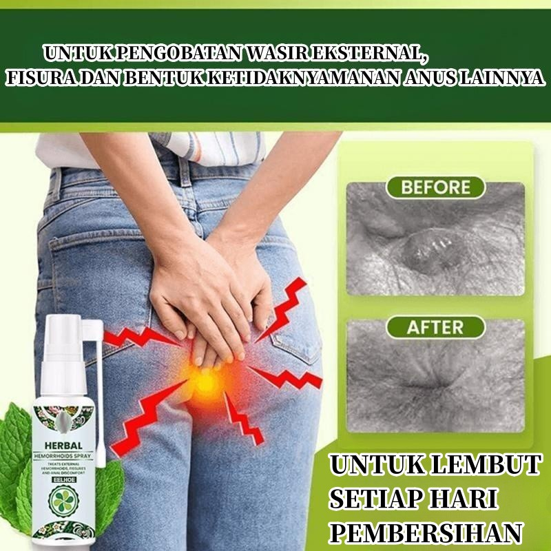 Obat Ambeyen Semprot Wasir Semprotan Herbal Alami efektif menghilangkan wasir EELHOE Herbal Spray Semprot Wasir Ambeien