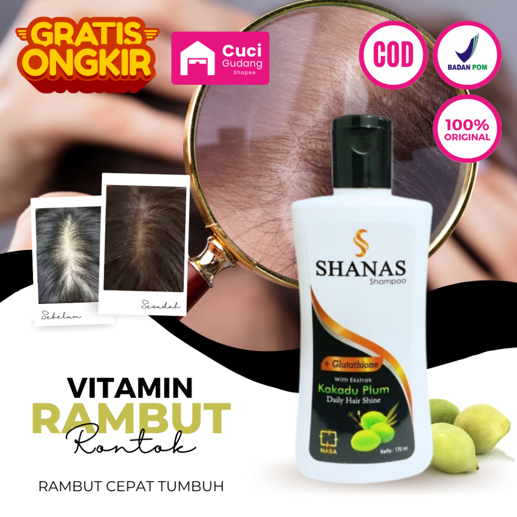Shampo Untuk Rambut Rontok Parah - Shampoo Pemanjang Rambut Tercepat Pria Wanita Shampo Anti Ketombe