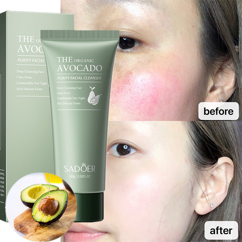 Avocadoessence Low PH Cleanser Facial Wash Gentle Cleanser For Sensitive Skin 100ml Avocado Face Wash