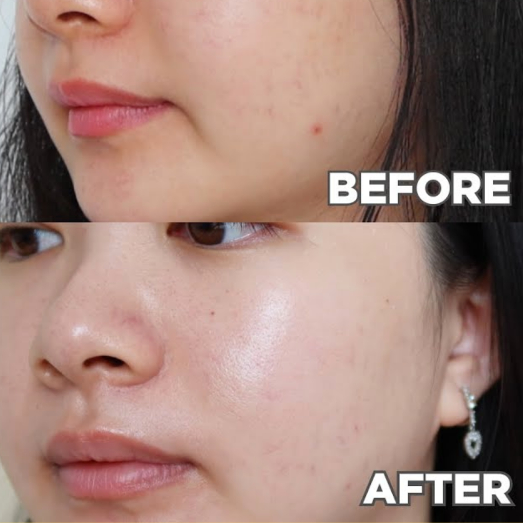 SOMETHINC 5% &amp; 10% Niacinamide + Moisture Sabi Beet Max Brightening Serum 20ml (100% ORIGINAL &amp; BPOM)