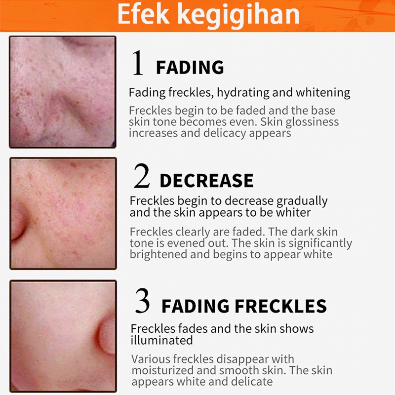 Krim pemutih wajah Crem pemutih wajah Face cream Vitamin C Whitening Krim Wajah Bintik-bintik Gelap Krim Wajah Perbaikan Memudar Bintik-bintik Melanin Remover