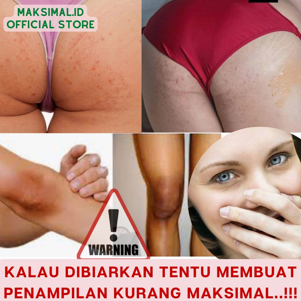 Pemutih selangkangan Pemutih ketiak Lotion pemutih tubuh Underarm Whitening cream Perawatan kewanitaan tubuh 60G Efektif memutihkan leher/tangan/kaki/miss v/Selangkangan/ ketiak/Aman dan tidak berbahaya