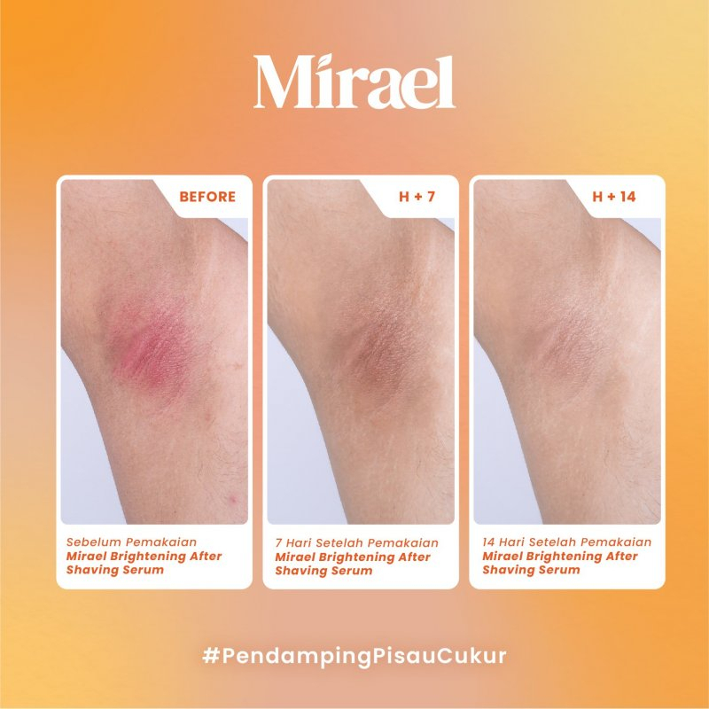 Mirael  After Waxing Serum (Brightening/Smoothing)(10ml/78ml)