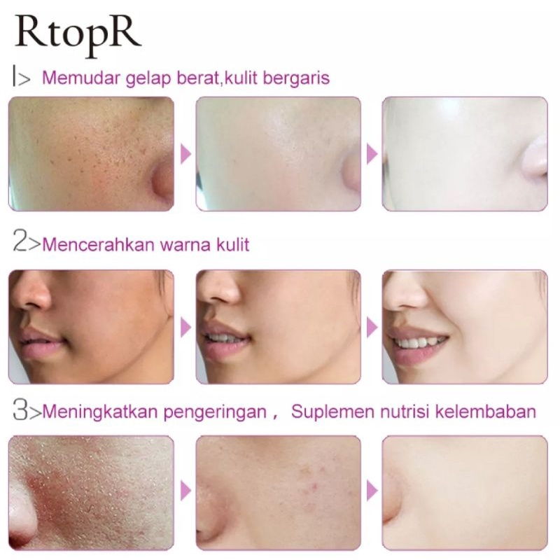 Rtopr Mango Bright Moisturizing Serum Serum Pemutih Anti Kerut Pelembab Wajah Perawatan Kulit Serum Anti Penuaan Wajah Jerawat Bersih Berseri-10ml