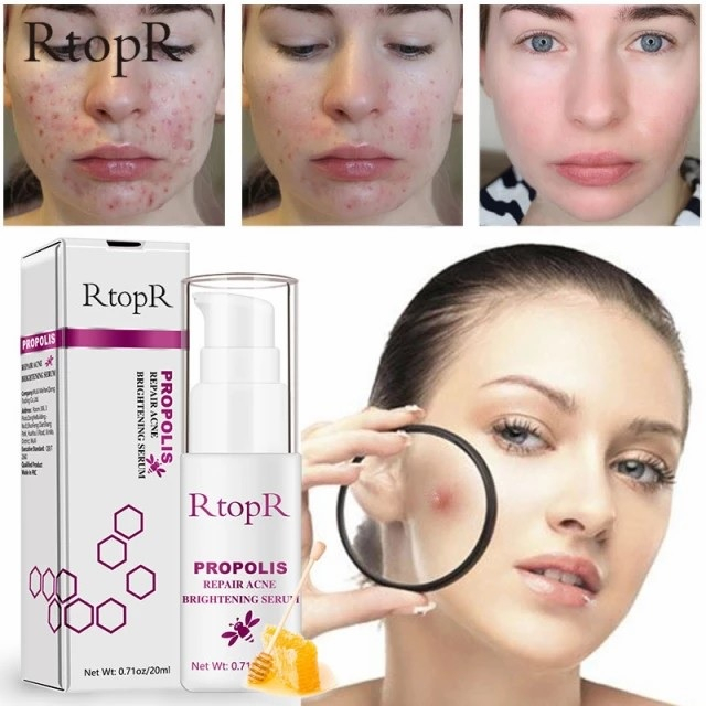 RtopR PROPOLIS Repair Acne Brightening Serum BRIGHTENING SERUM / JERAWAT / MENCERAHKAN