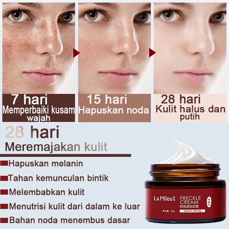 Cream pemutih wajah Krim bintik pemutih 30G Singkirkan melasma, bintik-bintik, bintik matahari, bintik-bintik penuaan, bintik-bintik kehamilan, bintik-bintik gelap Memperbaiki dasar kulit, memutihkan, melembabkan, mencerahkan kulit