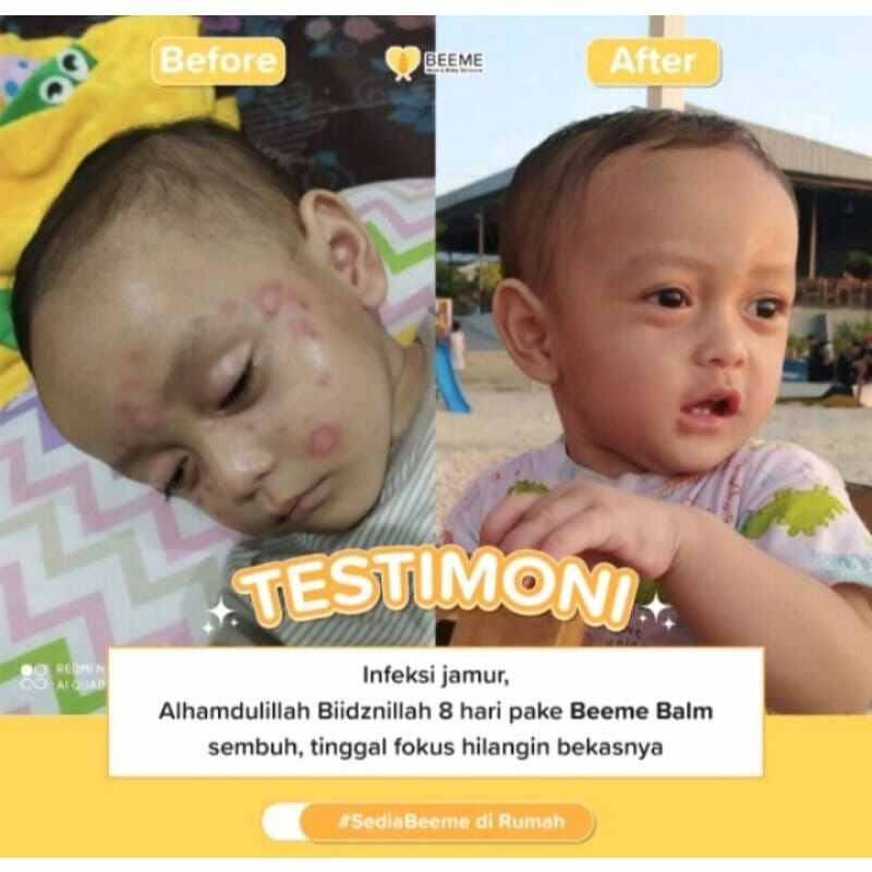 Paket Skincare Anak Perawatan Kulit Bayi Beeme Beemee Bemee Beme Bemme Beemme Bemmee Beemmee Bumil Busui Original Bpom Menutrisi Melembabkan Wajah