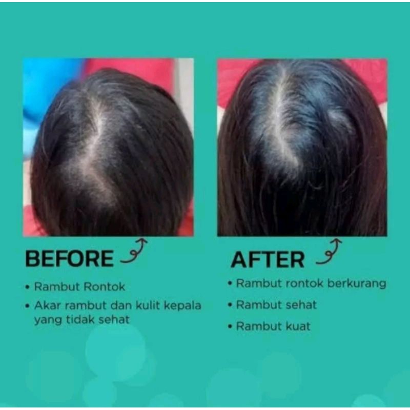 Keranity Intense Hair Serum/Penumbuh Rambut Alami 80ml