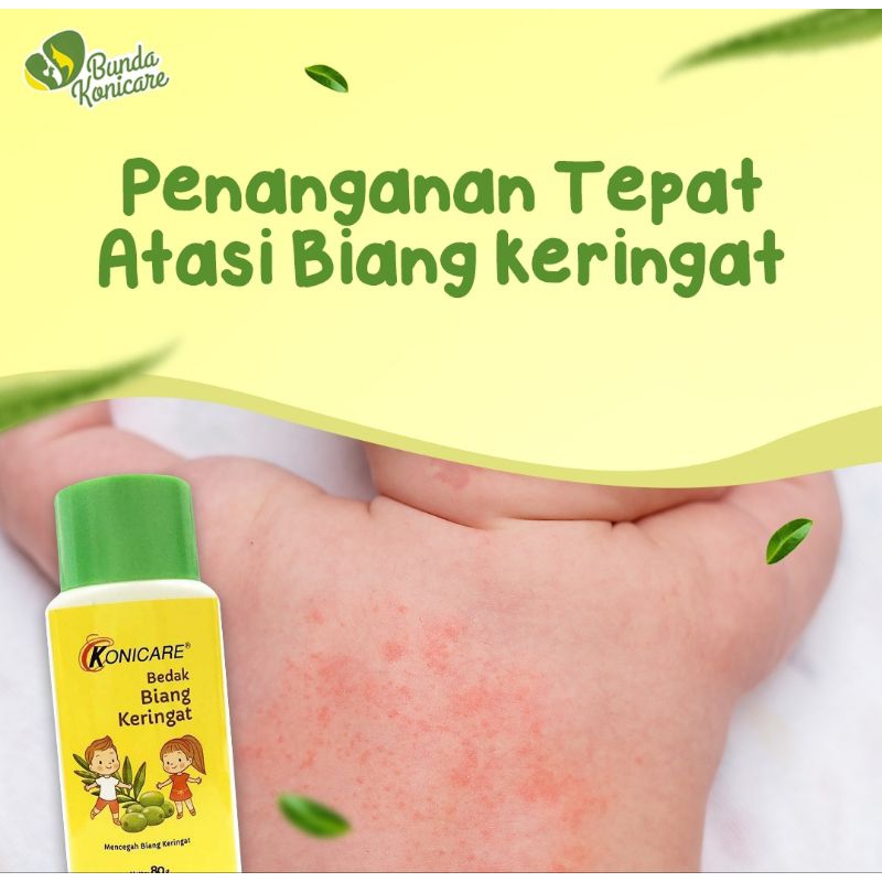 Konicare Bedak Gatal Biang Keringat 90 gr anak dewasa