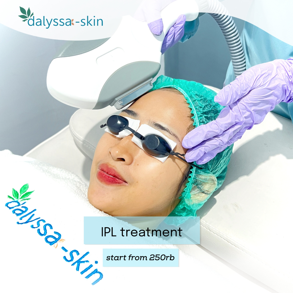IPL TREATMENT