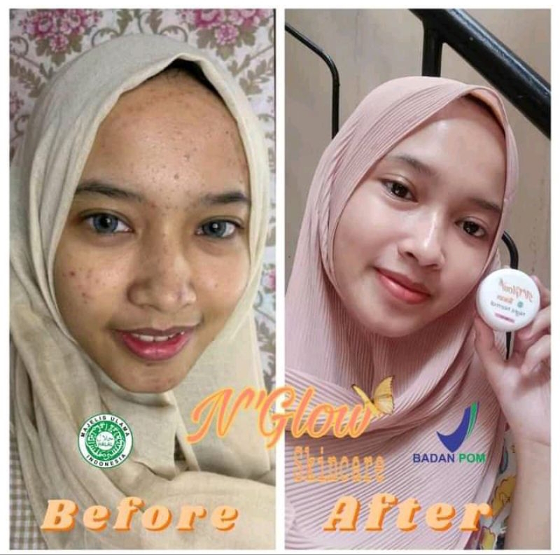 N'glow skincare Ori