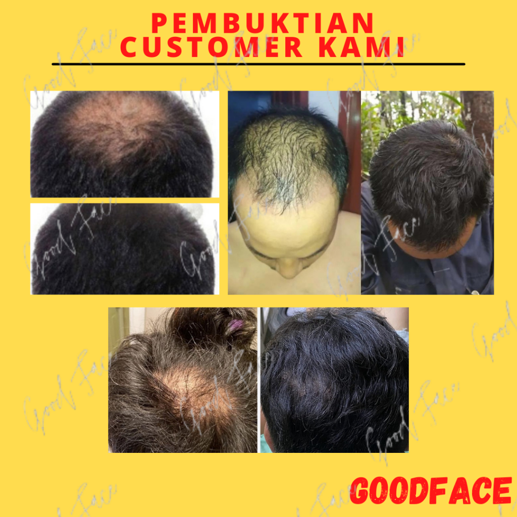 BIO HERBAL GINSENG PAKET SHAMPOO - HAIR TONIC - PENUMBUH RAMBUT BOTAK - TONIC RAMBUT PENUMBUH RAMBUT