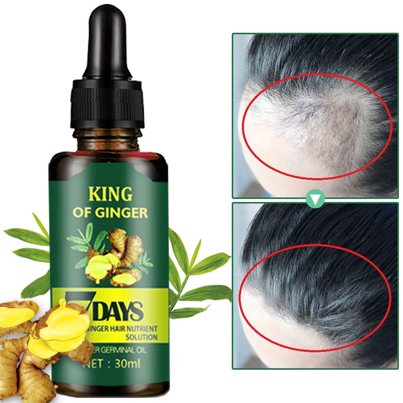 KING Rambut Esensi Cepat Penumbuh Rambut Botak Serum Nutrisi Rambut Jahe - 7 Days Hair Growth Essence Hair Cairan Essence 30ml Obat Penumbuh Rambut Cepat Anti Rontok Mengatasi Botak Serum Rambut Jahe