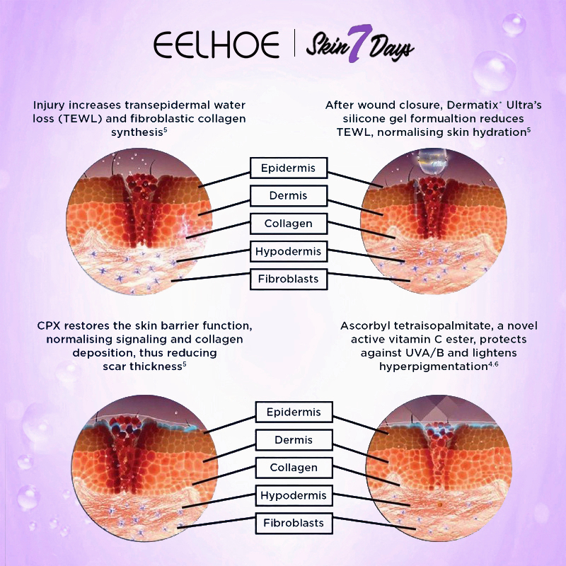 【Original 100%】EELHOE salep bekas luka Penghilang bekas luka obat penghilang bekas luka 50g dermatix penghilang bekas luka