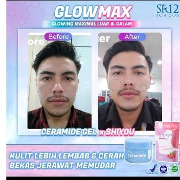 Shiyou SR12/SR12 Skincare/Produk SR12