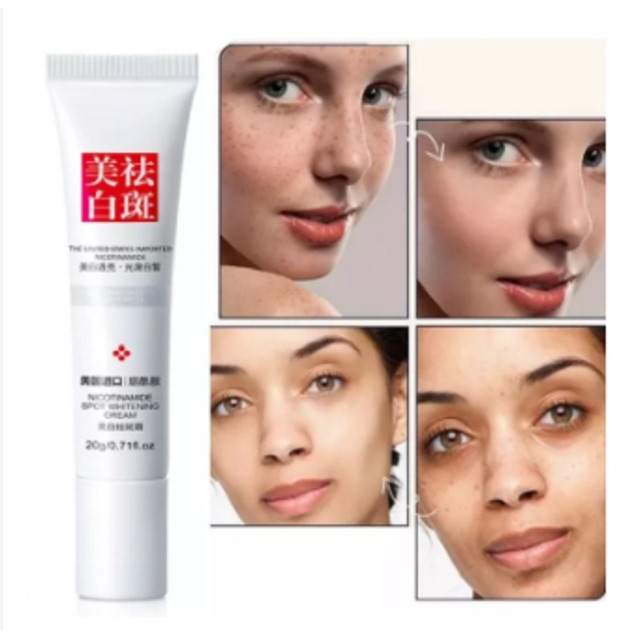 Pemutih Wajah Penghilang Kerutan Bintik Noda Hitam Anti Penuaan Youbuy Cream Whitening Brighten Creams 20g