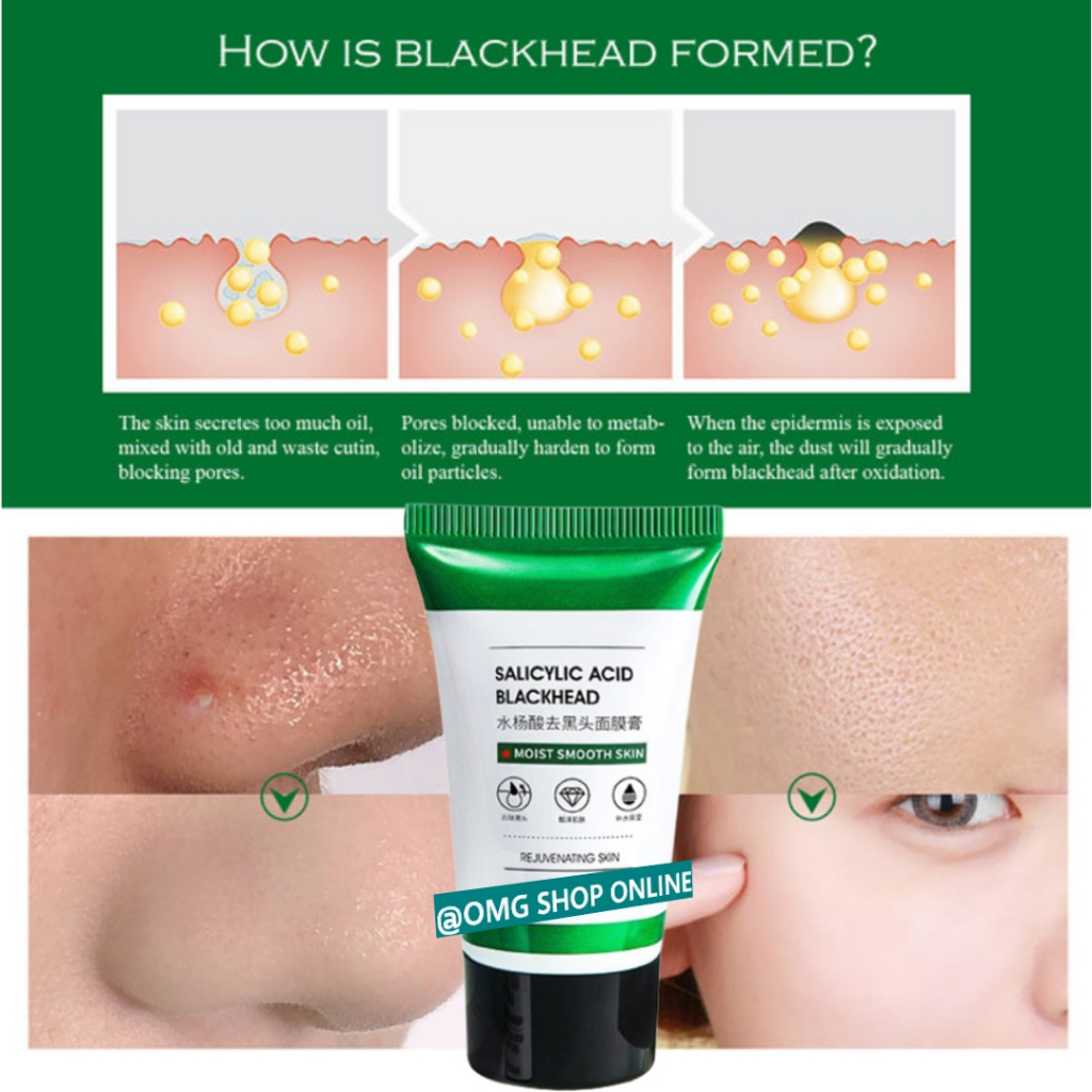 Beli 1 GRATIS 1 !!! Salicylic Acid Blackhead Mask Masker Komedo Arang Hitam 50 Gr ORI / Masker Wajah Glowing Putih Masker Komedo dan Pori Pori Penghilang Flek Hitam / Masker Peel Off Masker Organik Blackhead Remover Gel Masker Green Tea Carbon Charcoal