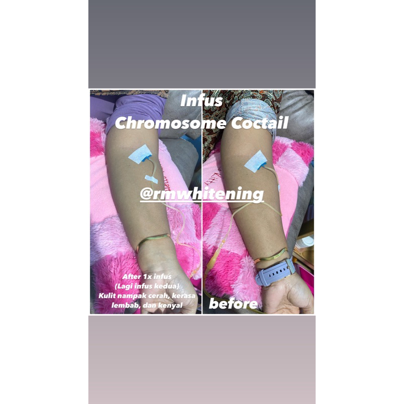 Infus Whitening CHROMOSOME COCTAIL