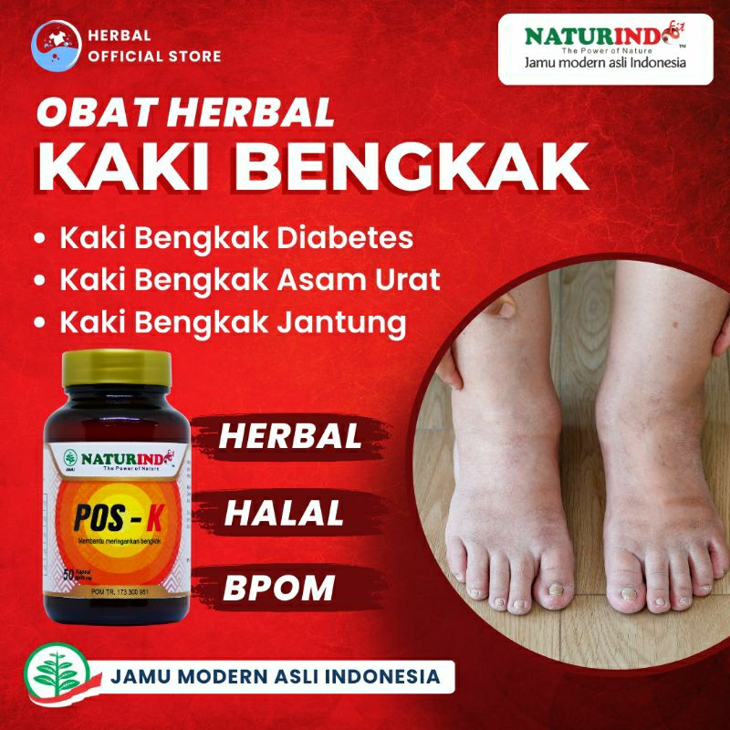 obat kaki bengkak obat kaki bengkak asam urat obat kaki bengkak karena jantung obat kaki bengkak asam urat obat kaki bengkak Kesleo obat kaki bengkak diabetes obat kaki bengkak