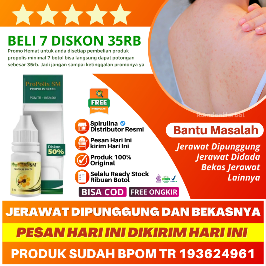 Obat Jerawat Punggung dan Bekasnya Propolis SM Brazil ORI