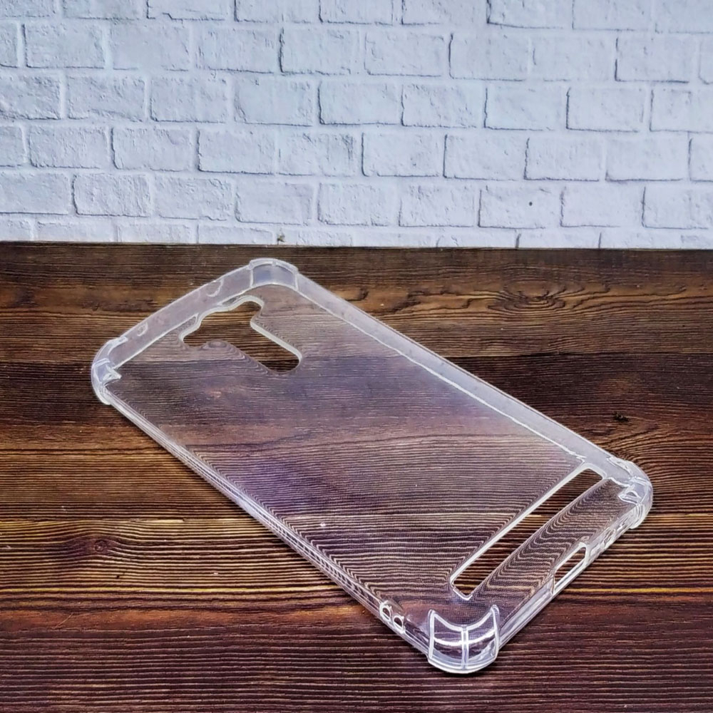 Ultrathin Softshell Oppo A31T Neo 5 Ultra Fit Softcase Jelly Case Casing Silikon Kesing Kasing Hp Sarung Handphone Kondom Hp Oppo Neo5