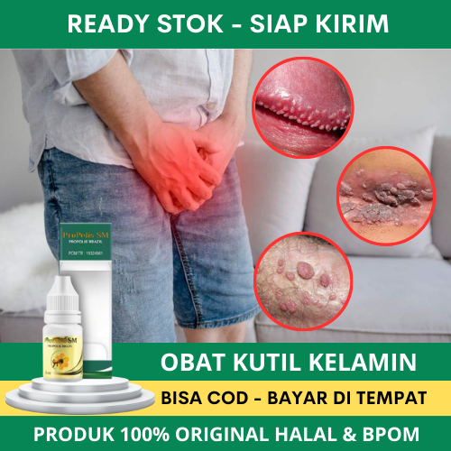Obat Kutil Kelamin, Obat Kutil di Kelamin, Obat Kutil Kelamin Herbal, Obat Kutil Kelamin HPV, Obat P