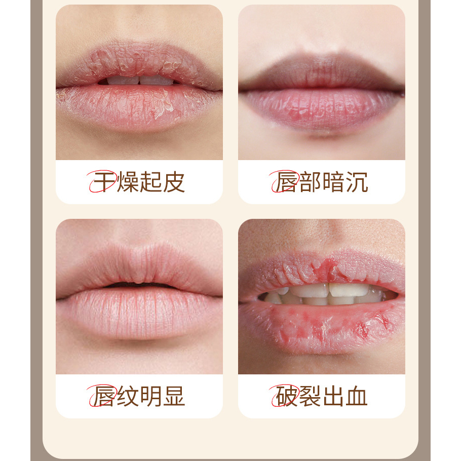 VEZE Moisturizing And Elastic Radian Charm Lips