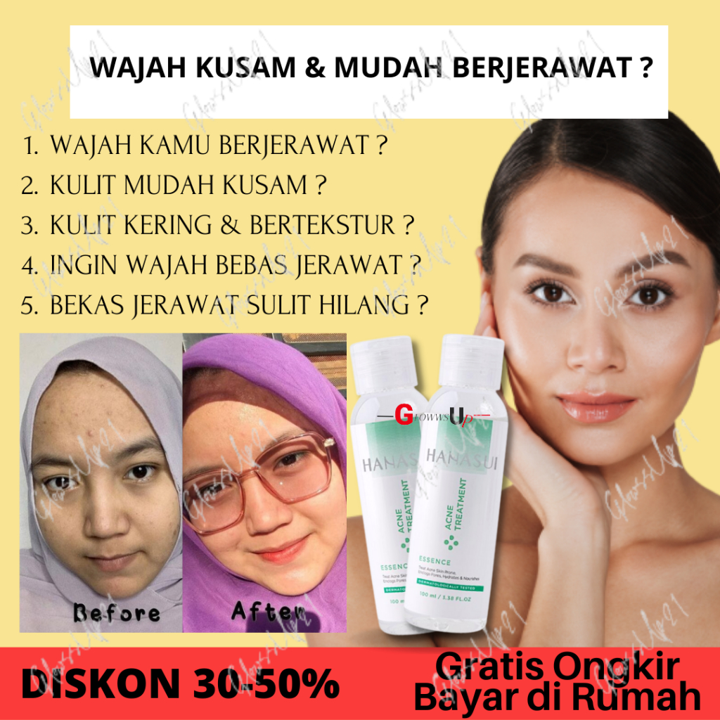 HANASUI ACNE TREATMENT ESSENSE 100ML BPOM - TREATMENT ESSENSE HANASUI