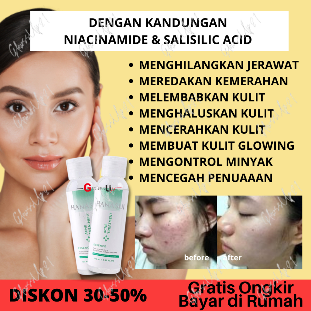 HANASUI ACNE TREATMENT ESSENSE 100ML BPOM - TREATMENT ESSENSE HANASUI