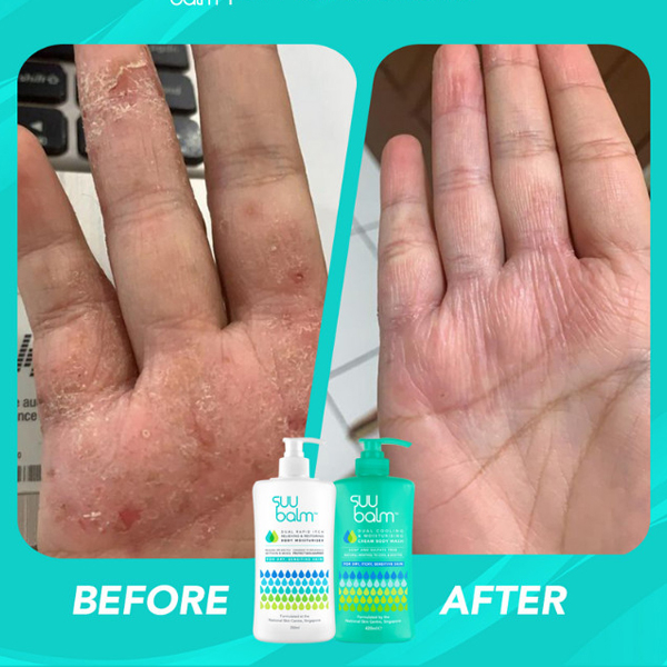 SUU Balm Adult Body Wash Cream Dry Itchy Sensitive Problem Skin 100ml