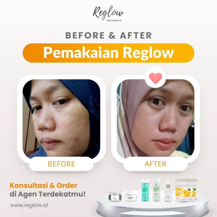 Reglow Glowing Skin Treatment Skincare Original Paket Lengkap By Dr Sindy Halal BPOM - Re Glow Paket Flek Hitam Darkspot Anti Aging