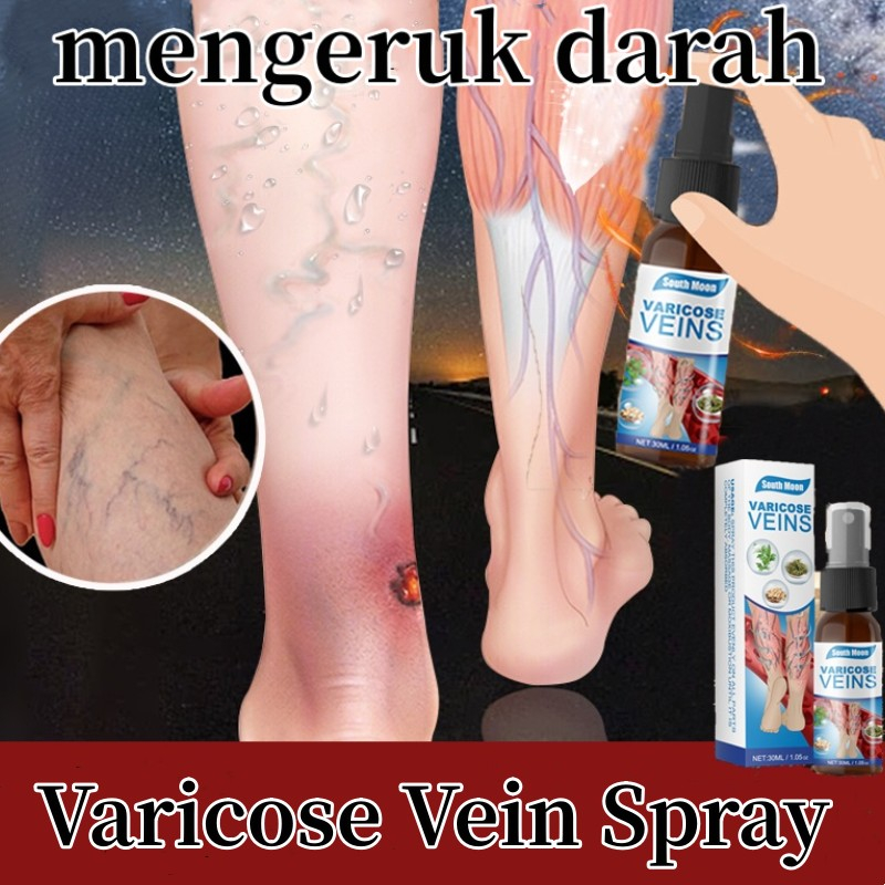 Varicose Veins Obat Varises Spray Penghilang Varises  Greenery Varicose and Spider Veins Remover 30m