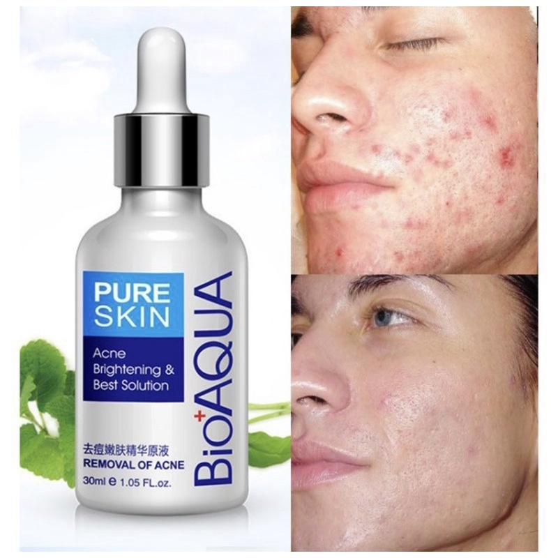 ACNE SERUM PURE SKIN BIOAQUA