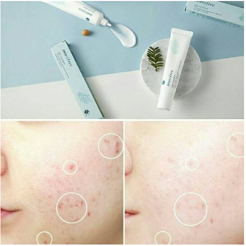 Bija Cica Balm 40ml Kulit Sensitif Berjerawat - Innisfree / BIja Cica Gel