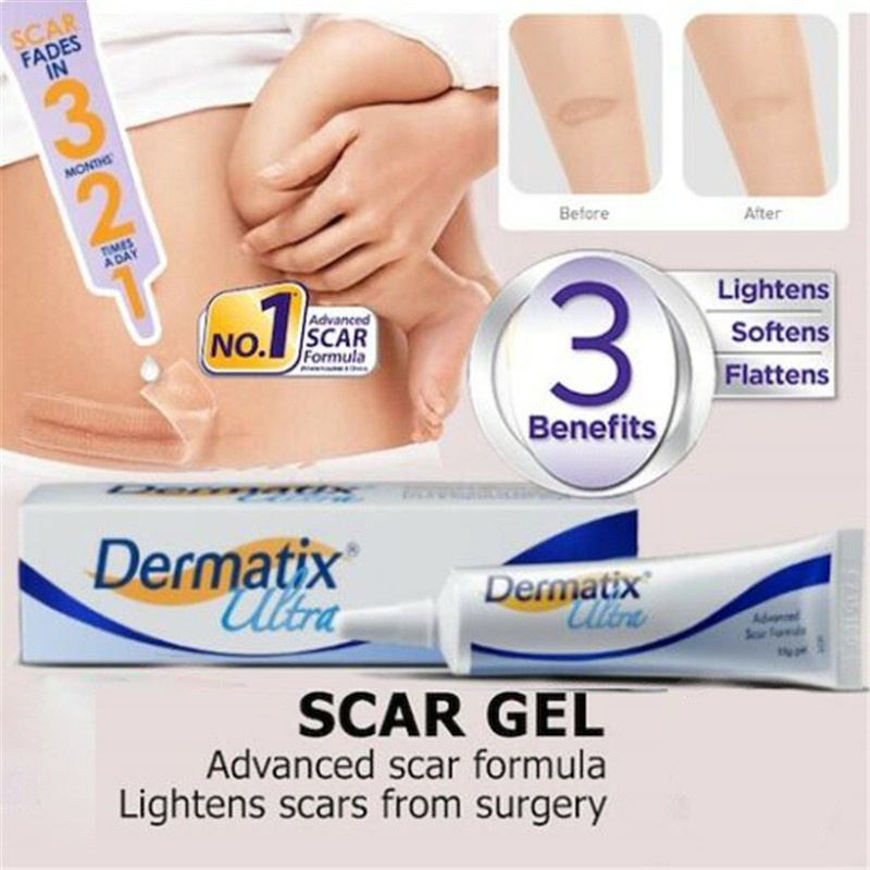 Dermatix Ultra Gel 15gr Advanced Scar Formula Gel LKrim Penghilang Bekas Luka / Bakar / Keloid Anti Scar Stretchmark Dermatik Dermatic